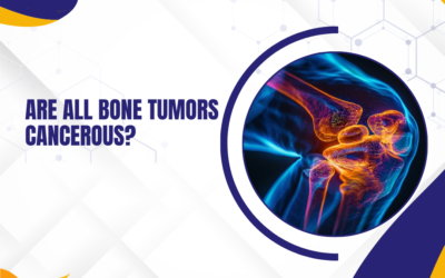 Are All Bone Tumors Cancerous?