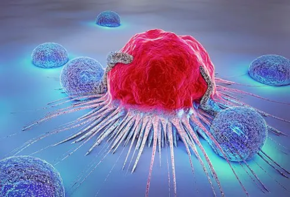 Red cancer cell with long filamentous extensions surrounded by blue immune cells in a lab micrograph.