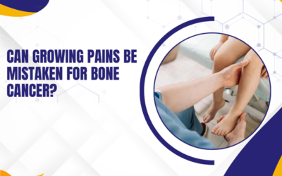 Can Growing Pains Be Mistaken for Bone Cancer?