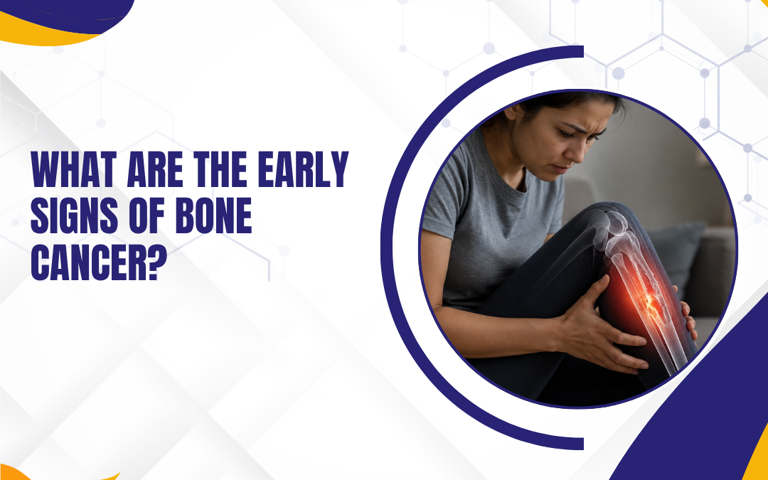 What Are the Early Signs of Bone Cancer?