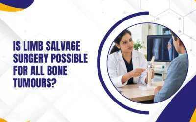 Is Limb Salvage Surgery Possible for All Bone Tumours?