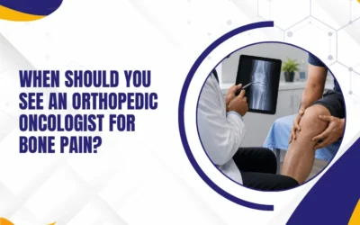 When Should You See an Orthopedic Oncologist for Bone Pain?