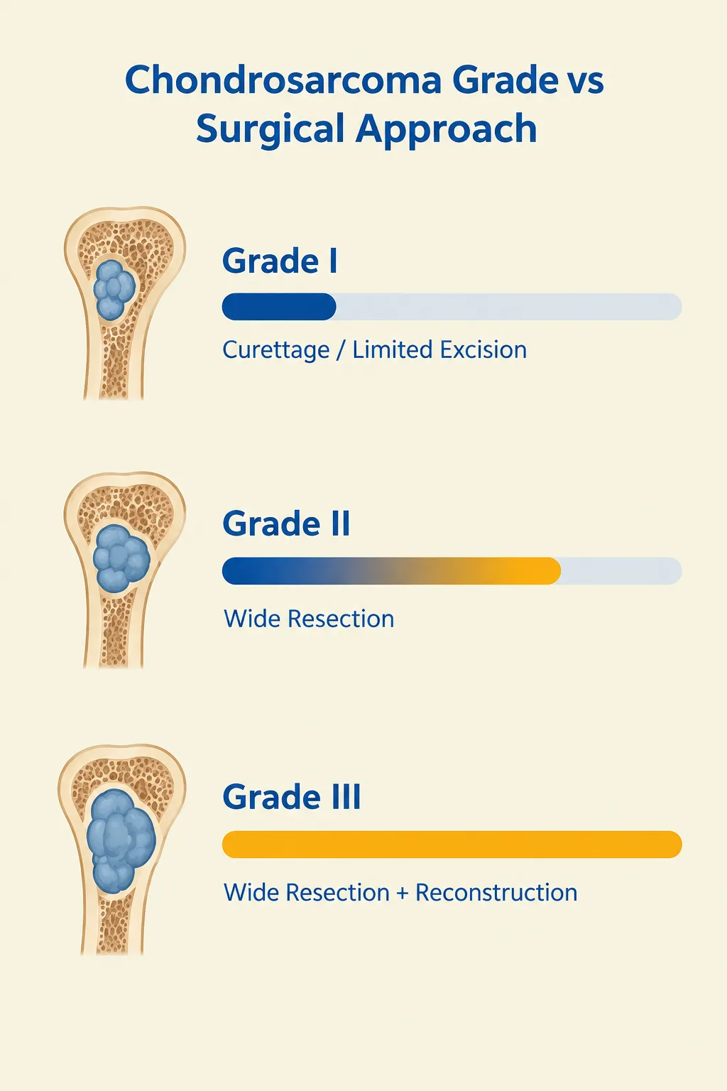 Bar chart comparing chondrosarcoma grade to surgical treatment approach by stage