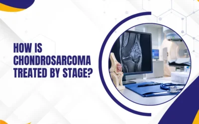 How Is Chondrosarcoma Treated by Stage?