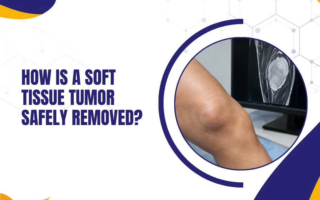 How Is a Soft Tissue Tumor Safely Removed